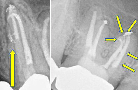 Endodontiezahnarztpraxis Eppendorfer Baum Dr Mohr Kollegen