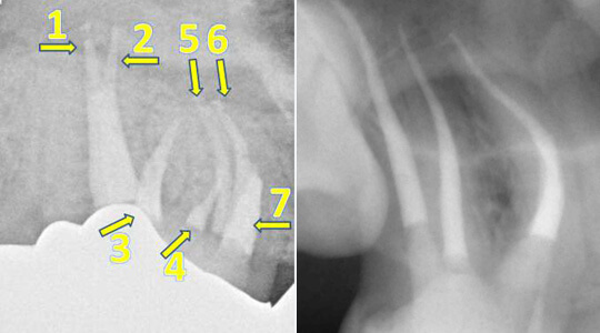 EndodontieZahnarztpraxis Eppendorfer Baum Dr. Mohr