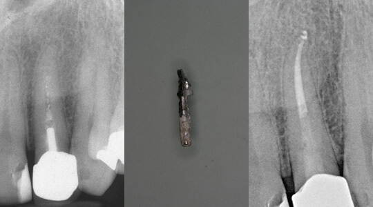 EndodontieZahnarztpraxis Eppendorfer Baum Dr. Mohr